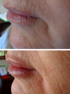 before-after-6